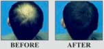 Hair Camouflage