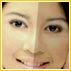Are there any skin whitening injections?