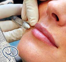 Botox - A Lunch-Time Treatment