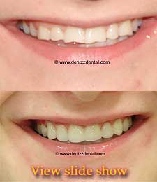 One Sitting Smile Makeovers