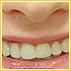 One Sitting Smile Makeovers